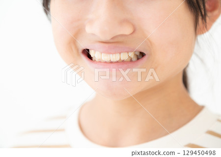 國中女生的牙齒 國中女生的牙齒 129450498