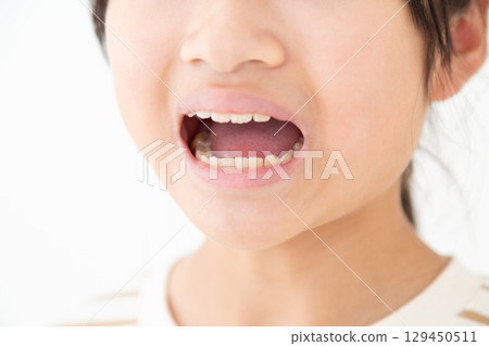 Middle school girl's teeth Middle school girl's teeth 129450511