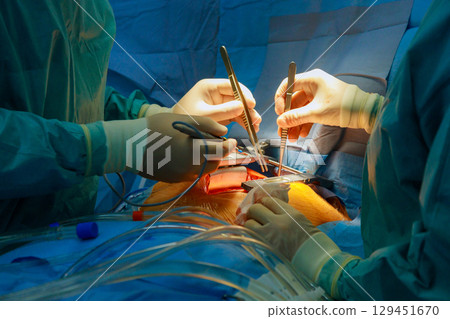 Multiple surgeons focus intently on complex surgery in operating room. Medical instruments and tools surround them, creating a serious atmosphere. 129451670