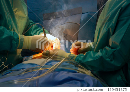 Two surgeons focused on performing surgery in operating room. Serious atmosphere filled with medical instruments and clinical intensity. 129451875