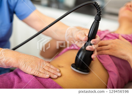 Closeup of hardware procedure of rf skin lifting on female belly 129456596