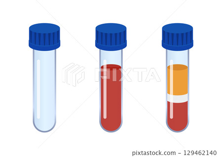 Medical test tubes showing blood and plasma analysis stages Medical test tubes showing blood and plasma analysis stages 129462140