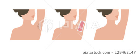 Woman using waxing strips for armpit hair removal 129462147