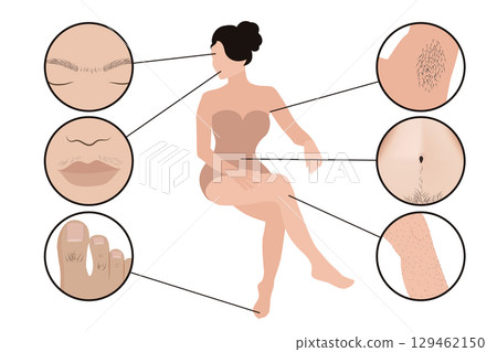 Woman showing body parts where hair removal is usually performed Woman showing body parts where hair removal is usually performed 129462150