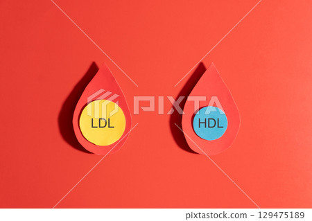 High cholesterol concept. LDL cholesterol with yellow spherical particles and HDL cholesterol with blue spherical particles inside blood droplets on red background. Cardiovascular disease problem. High cholesterol concept. LDL cholesterol with yellow spherical particles and HDL cholesterol with blue spherical particles inside blood droplets on red background. Cardiovascular disease problem. 129475189