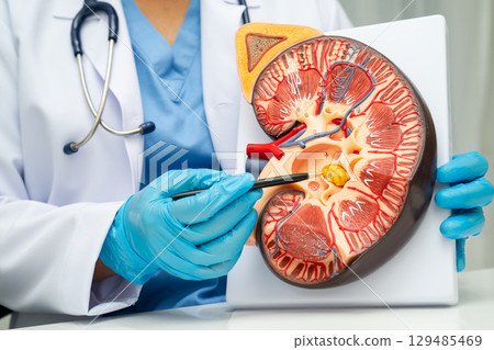 Chronic kidney disease, doctor with model for treatment urinary system, urology, Estimated glomerular filtration rate eGFR. 129485469