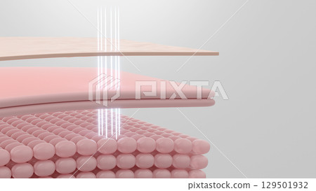CG copy space of lift-up treatment using HIFU (Hifu) to work on the SMAS layer 129501932