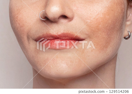 Cropped Womans face with pigmentation, melasma, freckles, age spots photo. Close up photo texture 129514206