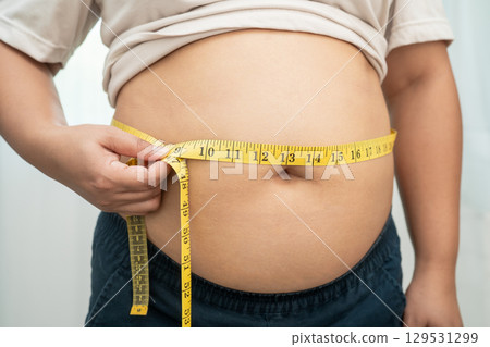 Asian woman with fat belly big size overweight and obesity with measure tape. Asian woman with fat belly big size overweight and obesity with measure tape. 129531299