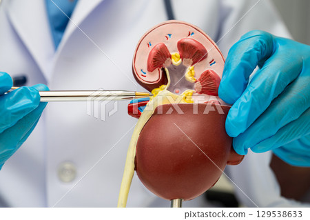 Chronic kidney disease, doctor with model for treatment urinary system, urology, Estimated glomerular filtration rate eGFR. Chronic kidney disease, doctor with model for treatment urinary system, urology, Estimated glomerular filtration rate eGFR. 129538633