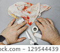 Male hands with bandaged injured fingers  129544439