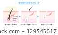 Image of hair removal, illustration of beauty hair removal and laser hair removal 129545017