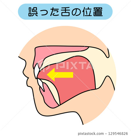 How to mew properly: correct and incorrect tongue position 129546826