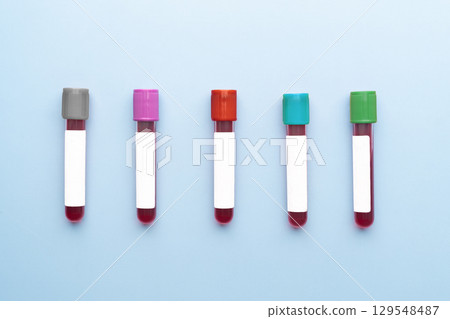 Blood sample test tubes set on blue background. Different blood collection tubes of various colors serve distinct purposes in clinical laboratory testing. 129548487