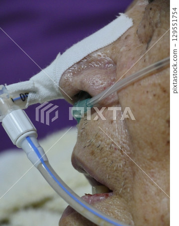 Nasogastric tube Nasogastric tube 129551754