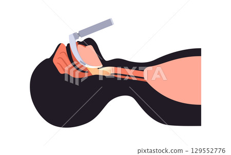 Laryngoscopy medical procedure Laryngoscopy medical procedure 129552776