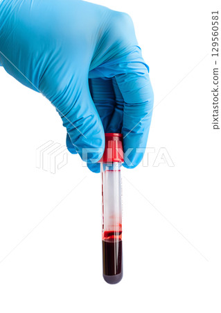 Gloved hand holding blood sample in test tube, medical laboratory analysis concept isolated on transparent background 129560581