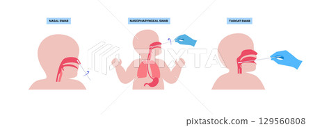 swab medical procedure 129560808
