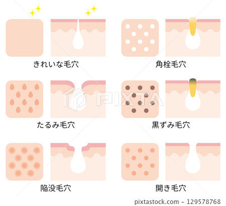 毛孔問題圖解 129578768