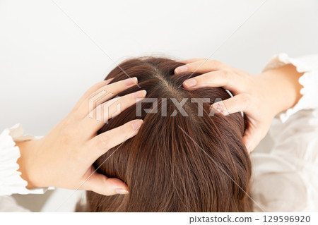 Women's scalp problems 01 129596920