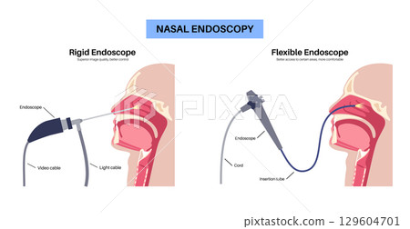 Nasal endoscopy poster Nasal endoscopy poster 129604701