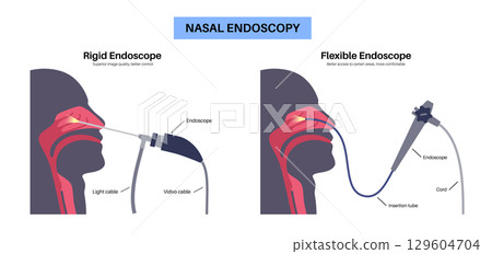 Nasal endoscopy poster 129604704