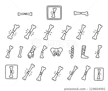Bone line icons set. Bone fracture symbols. Design elements for medical diagram or website. Simple vector outline collection isolated on white background. Bone line icons set. Bone fracture symbols. Design elements for medical diagram or website. Simple vector outline collection isolated on white background. 129604991