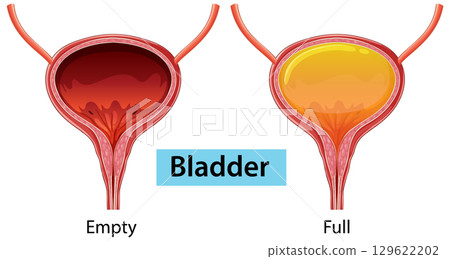 Human Bladder Illustration: Empty and Full States Human Bladder Illustration: Empty and Full States 129622202