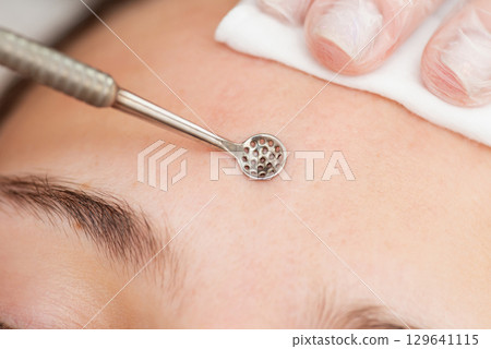 Close up of procedure of cleaning skin with steel tool in beauty salon. Cosmetologist making cleansing therapy, removing blackheads and acne from the forehead of a woman 129641115