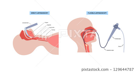Laryngoscopy medical procedure 129644787