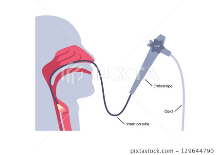 Laryngoscopy medical procedure Laryngoscopy medical procedure 129644790