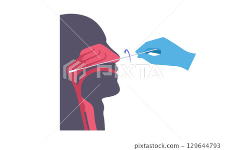Nasopharyngeal swab procedure Nasopharyngeal swab procedure 129644793