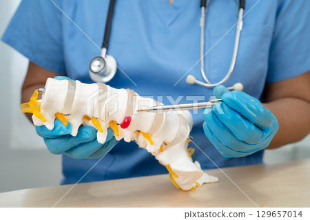 Asian doctor holding spinal nerve and bone model, Lumbar spine displaced herniated disc fragment for treatment medical in the orthopedic department. 129657014