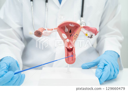 Doctor holding human uterus model for vaginal and cervix pap smear check up in the obstetrics and gynecology. Doctor holding human uterus model for vaginal and cervix pap smear check up in the obstetrics and gynecology. 129660479