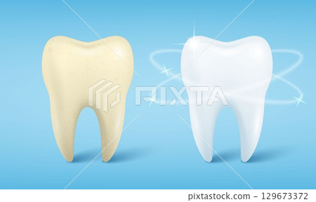Vector Banner with Realistic Dirty and Clean Tooth. Cleaning Concept, Before, After Hygienic Teeth Cleaning. Dentistry Design for Medical, Toothpaste Advertisement. Healthy Oral Hygiene, Teeth Care Vector Banner with Realistic Dirty and Clean Tooth. Cleaning Concept, Before, After Hygienic Teeth Cleaning. Dentistry Design for Medical, Toothpaste Advertisement. Healthy Oral Hygiene, Teeth Care 129673372