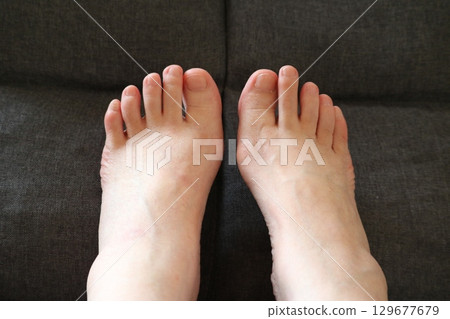 Foot body parts senior woman 129677679