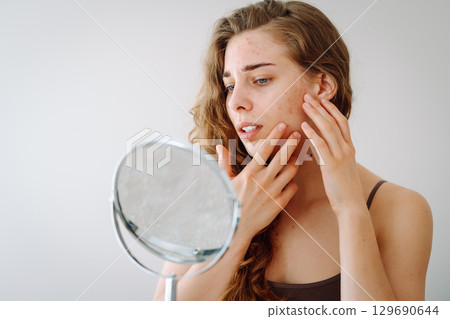 curly woman with rashes on her face is worried about the health of her skin. Dermatology concept. 129690644