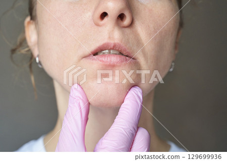 Caucasian adult female skin examination with gloved hands observing facial 129699936