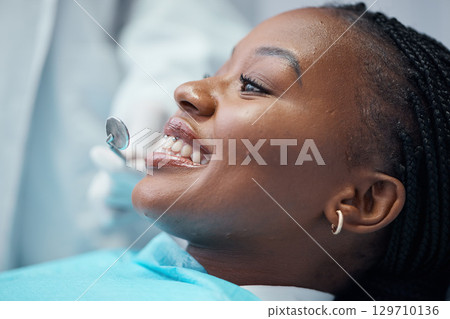 Face, dental and black woman at dentist, orthodontics tools with teeth cleaning and smile for healthcare check. Health for mouth, teeth whitening and tooth decay with oral hygienist and gum disease 129710136