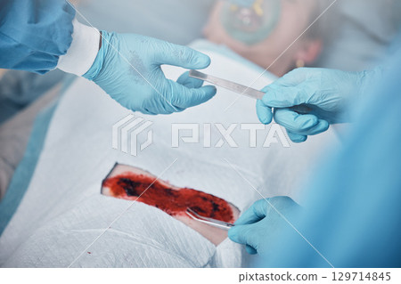 Hands, blood and operation with a team of doctors at work during surgery with equipment or a tool in a hospital. Doctor, nurse and collaboration with a medicine professional group saving a life 129714845
