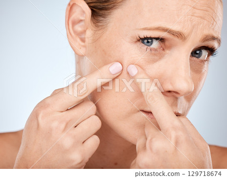 Health, skincare and woman squeeze acne in face with studio background. Skin care, morning facial and lady with flaws, blemish and imperfection pop pimple or blackhead with fingers and hands. 129718674