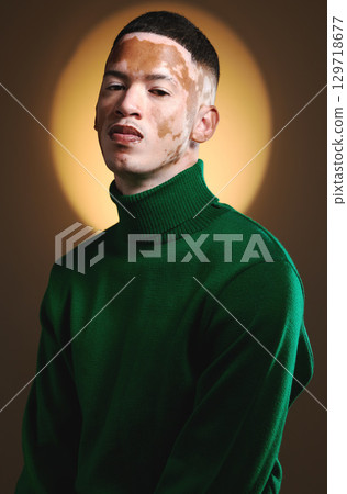 Vitiligo, portrait and male fashion model in stylish, trendy and fashionable outfit on a brown studio background. Backdrop, edgy and artistic man posing in green clothing with a cool attitude Vitiligo, portrait and male fashion model in stylish, trendy and fashionable outfit on a brown studio background. Backdrop, edgy and artistic man posing in green clothing with a cool attitude 129718677