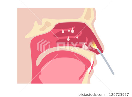 Nasal endoscopy poster 129725957