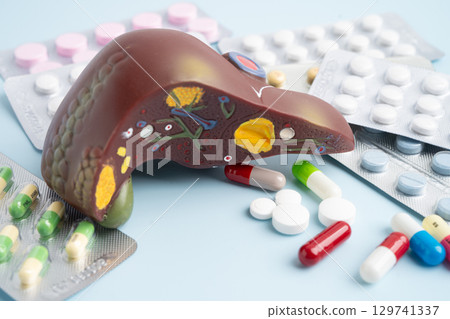 Liver model with pill drug treatment, Cirrhosis, Liver cancer, fatty liver. 129741337