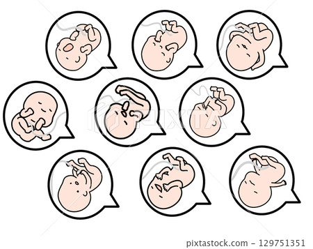 胎兒有各種面部表情 胎兒有各種面部表情 129751351