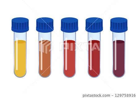Five test tubes containing different colored blood Five test tubes containing different colored blood 129758916
