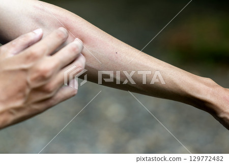 People feel itchy skin while practicing exercise in a public park outdoors. Concept of a Healthy active lifestyle People feel itchy skin while practicing exercise in a public park outdoors. Concept of a Healthy active lifestyle 129772482