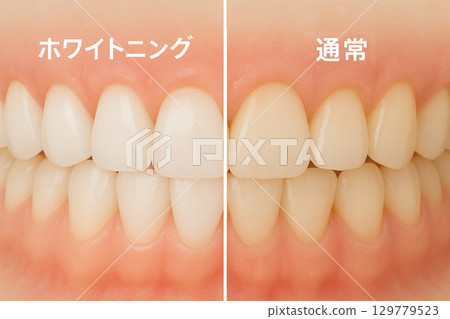 美白、清潔、美容牙科 美白、清潔、美容牙科 129779523