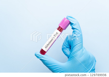 Blood sample tube with Alzheimer test label on medical laboratory technologist hands over blue background. A blood test that can help detect early signs of Alzheimer disease. 129789936