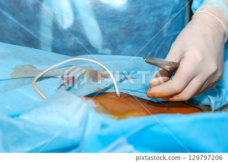 Surgeon performing a delicate surgical procedure in a hospital operating room 129797206